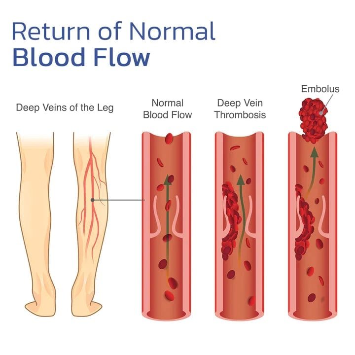 自動加熱膝サポーター:痛みの迅速な緩和
