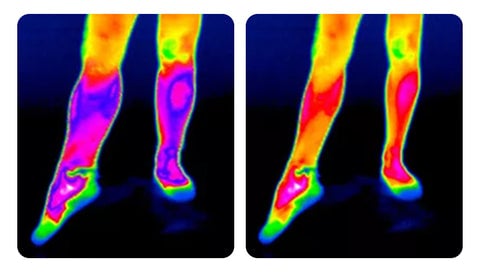 自動加熱膝サポーター:痛みの迅速な緩和